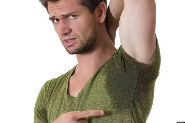 Excessive Sweating - How To Deal With The Problem?