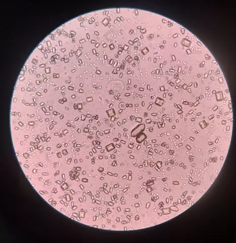 Bacterial Urine Culture - Analysis Interpretation