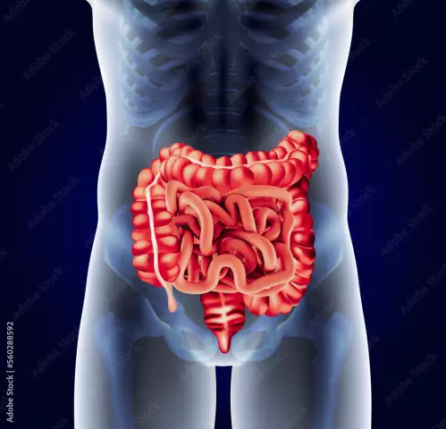 Colonoscopy Of The Intestine