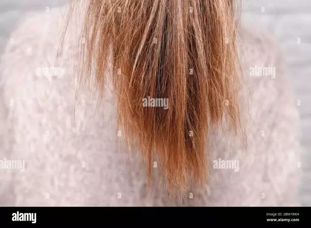 Doppie Punte Dei Capelli - Cosa Fare?