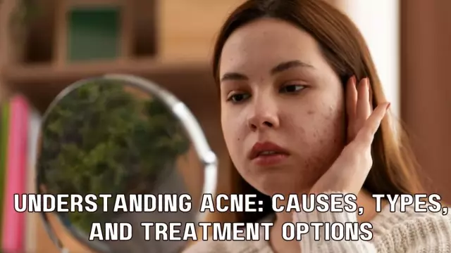 How To Deal With Acne: Causes Of A Rash And How To Fix It