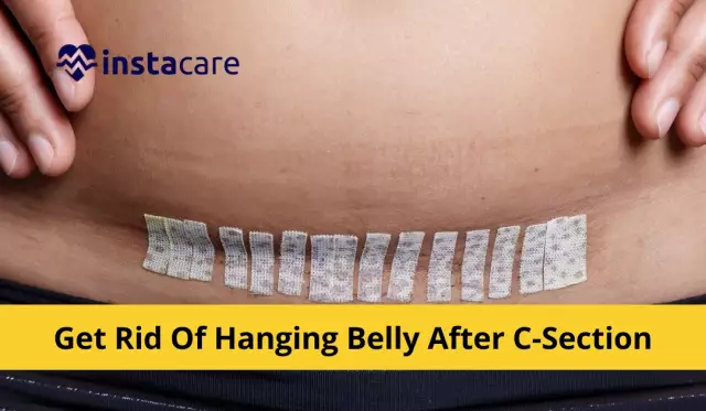 How To Remove Belly After Childbirth?