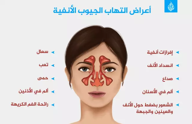 Treatment Of Sinusitis At Home