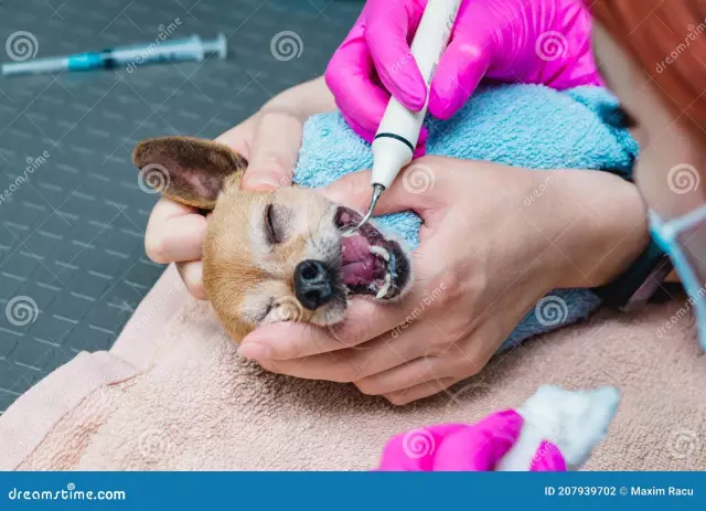 Ultrasonic Teeth Cleaning