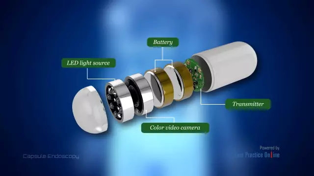 Capsule Endoscopy Capabilities