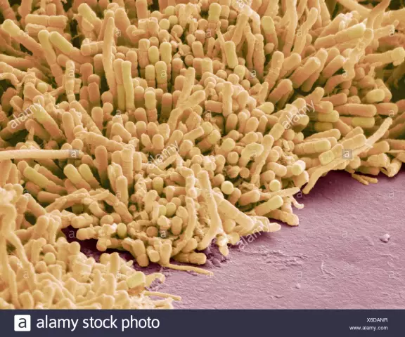 How Plaque Forms On Teeth