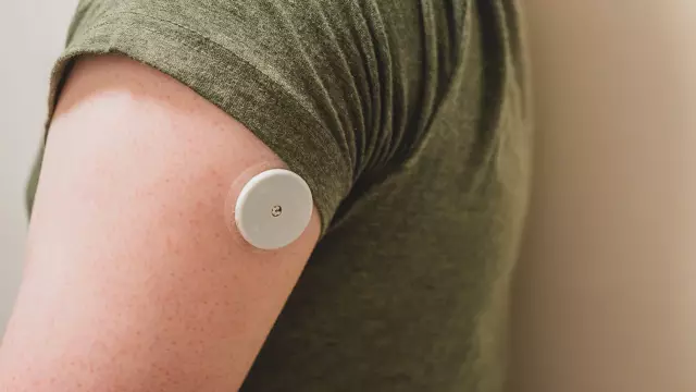 The Revolutionary FreeStyle Libre Flash Glucose Monitoring System