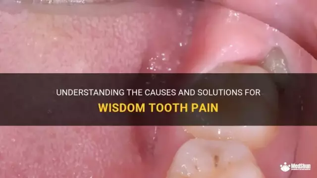 Tooth Hurts After Nerve Removal