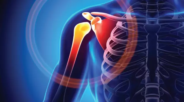 Why Elbow Hurts - Possible Causes, Diagnosis, Treatment