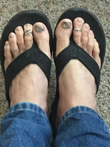 What Makes Your Toes Hurt