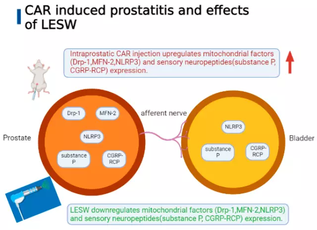 Cure Prostatitis Due To The Triple Pathogenetic Action Of Longidaza®