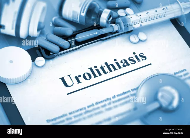 Progressive And Painless Method Of Treatment Of Urolithiasis