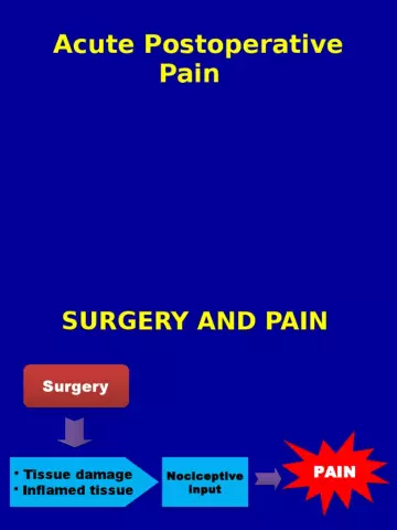 Surgery - New In Postoperative Pain Management