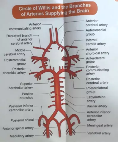 Circle Of Willis - Development, Treatment, Symptoms