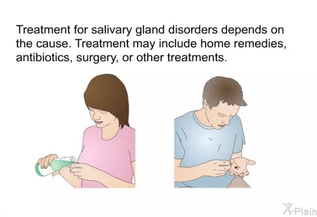 Salivary Glands - Disease, Treatment, Removal