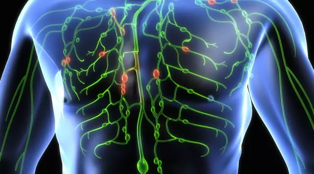 Lymphatic System - Functions, Diseases, Cleansing