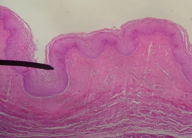 Angiovitis - Instruksi, Gunakan Selama Kehamilan, Ulasan, Harga