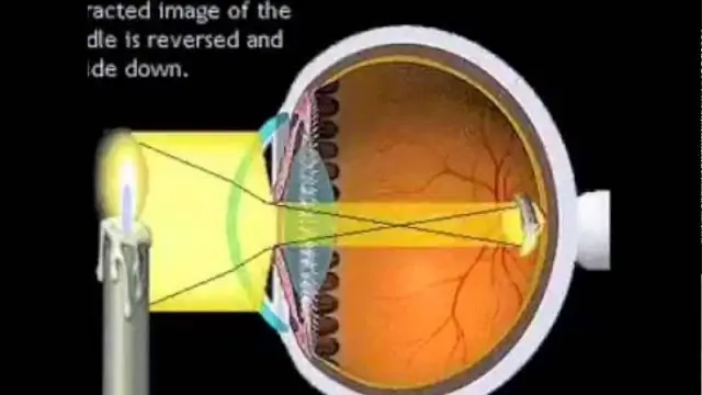 Oxybuprocaine - Mode D'emploi Des Gouttes Oculaires, Analogues, Prix