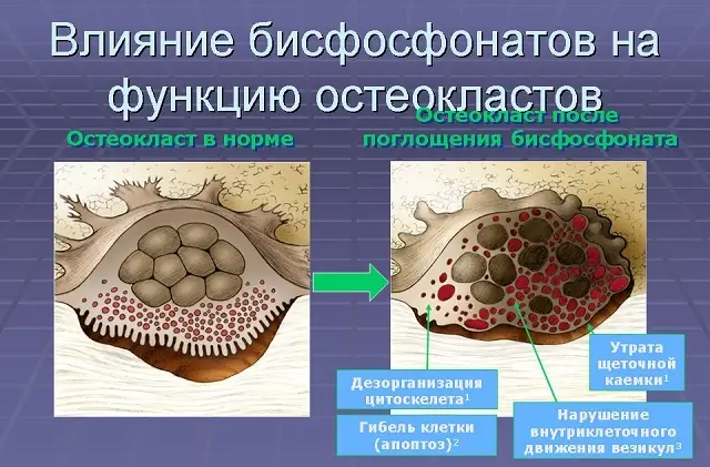 Osterepar - Tablečių Vartojimo Instrukcijos, Kaina, Analogai, Apžvalgos