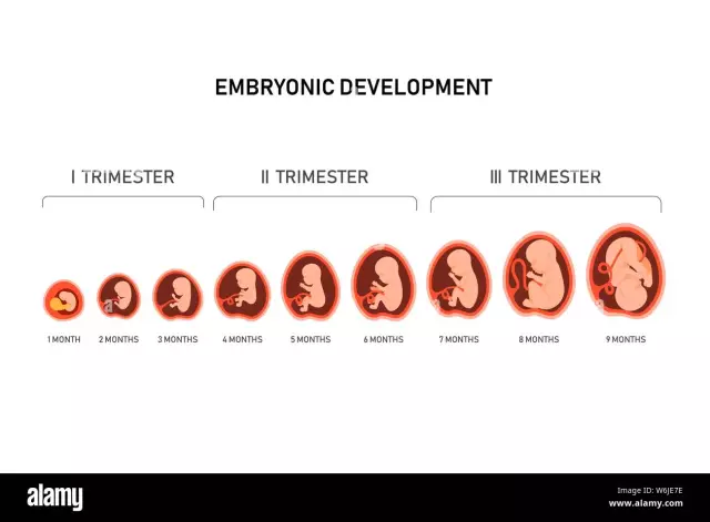 9 Weeks Pregnant - Fetal Size, Abdomen, Pain