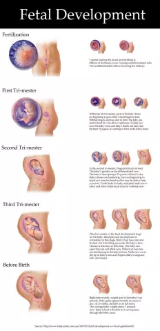 20th Week Of Pregnancy - Fetal Size, Abdomen, Pain